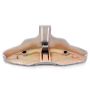 Kit Capa De Pinça Amarela Dub Spoiler Ideal Para Parachoques Amarelo