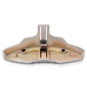 Par Capa Pinça De Freio Esportiva Dub Jetta Cor Branco